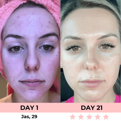 AURORA 7-in-1 LED Facial Sculptor