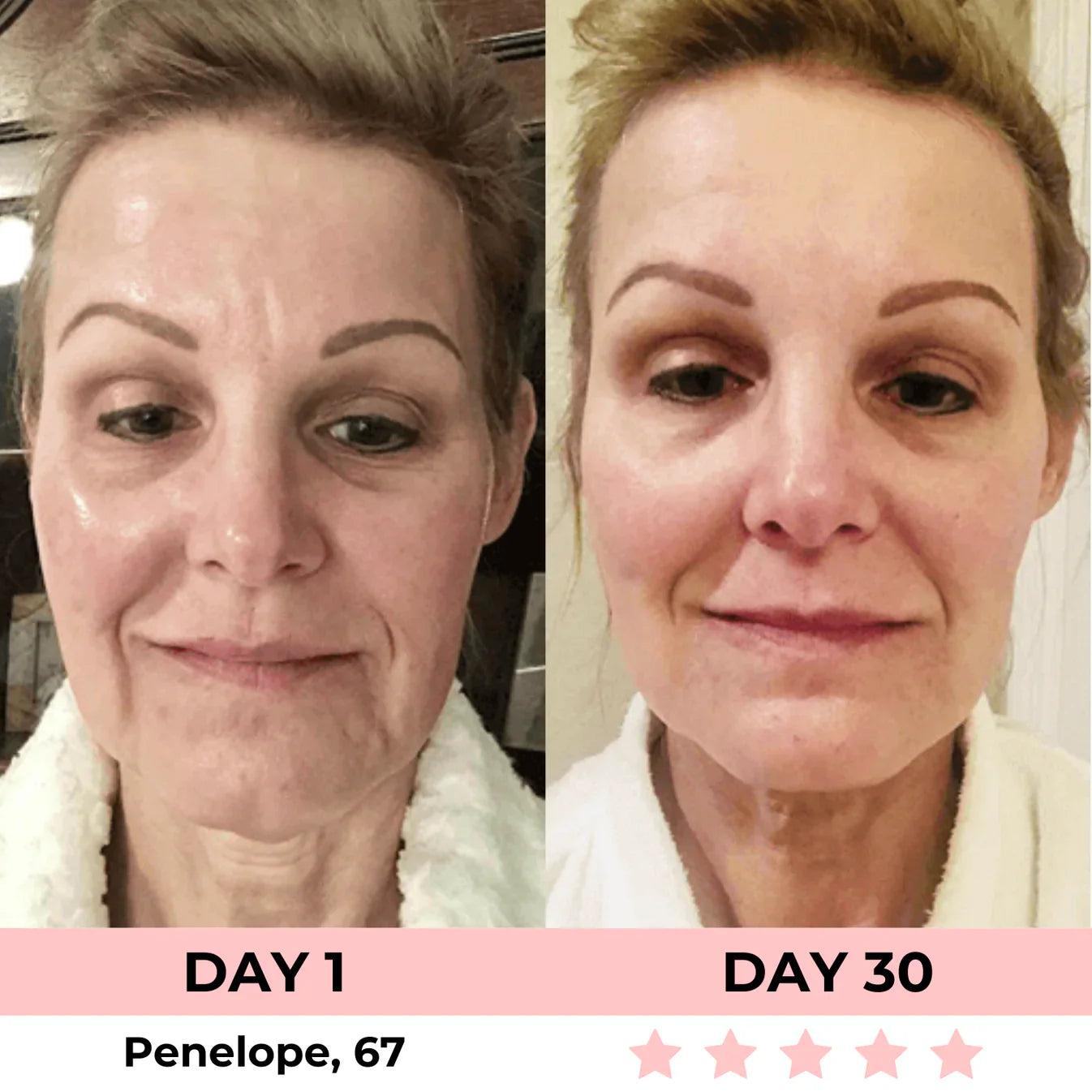 AURORA 7-in-1 LED Facial Sculptor