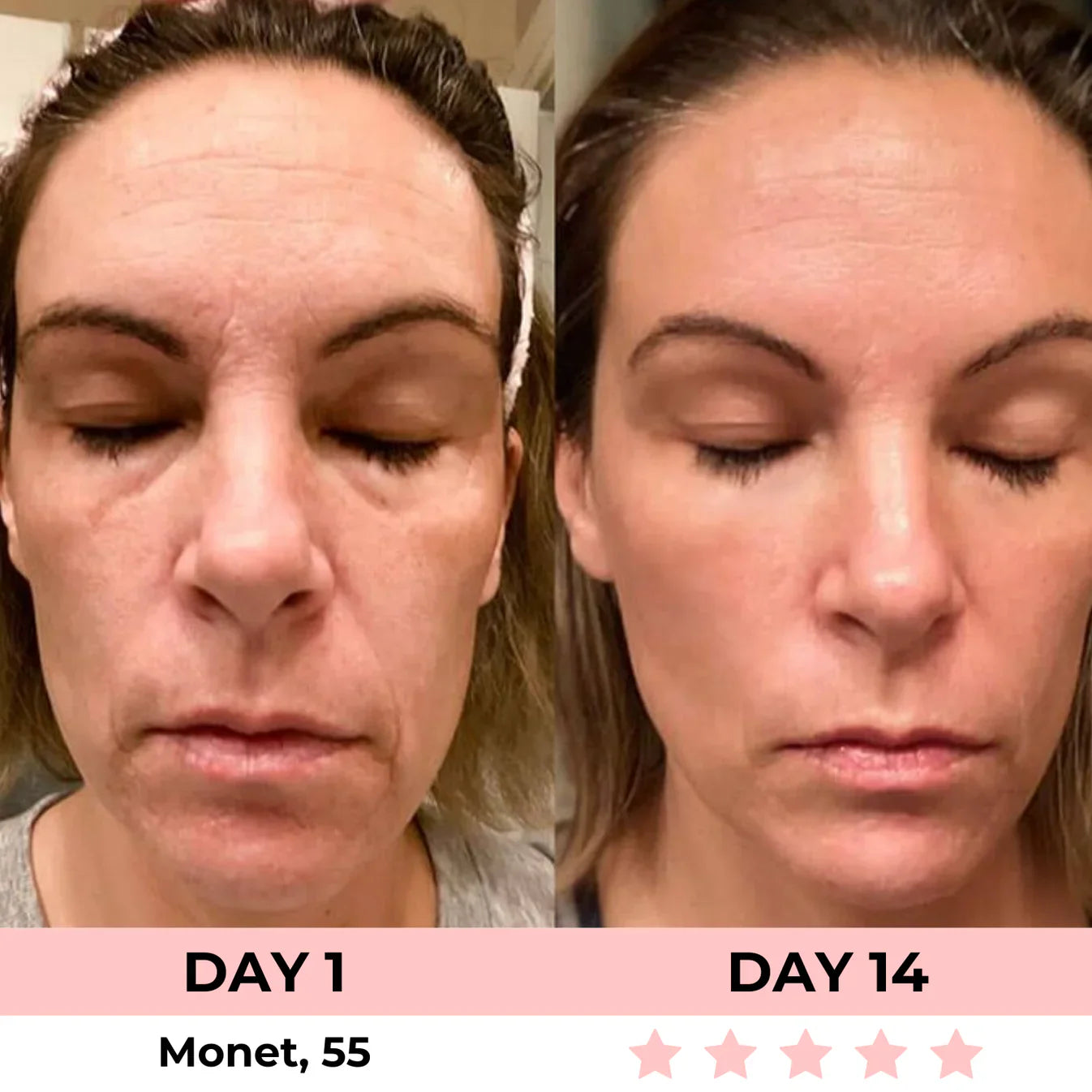 AURORA 7-in-1 LED Facial Sculptor