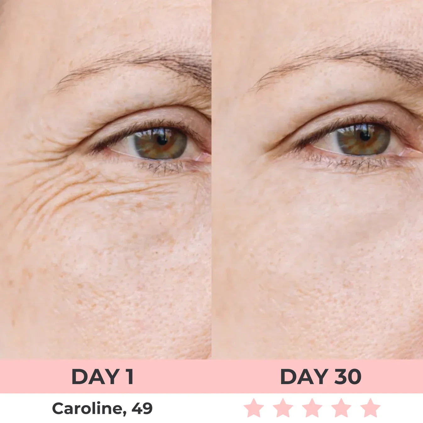 AURORA 7-in-1 LED Facial Sculptor