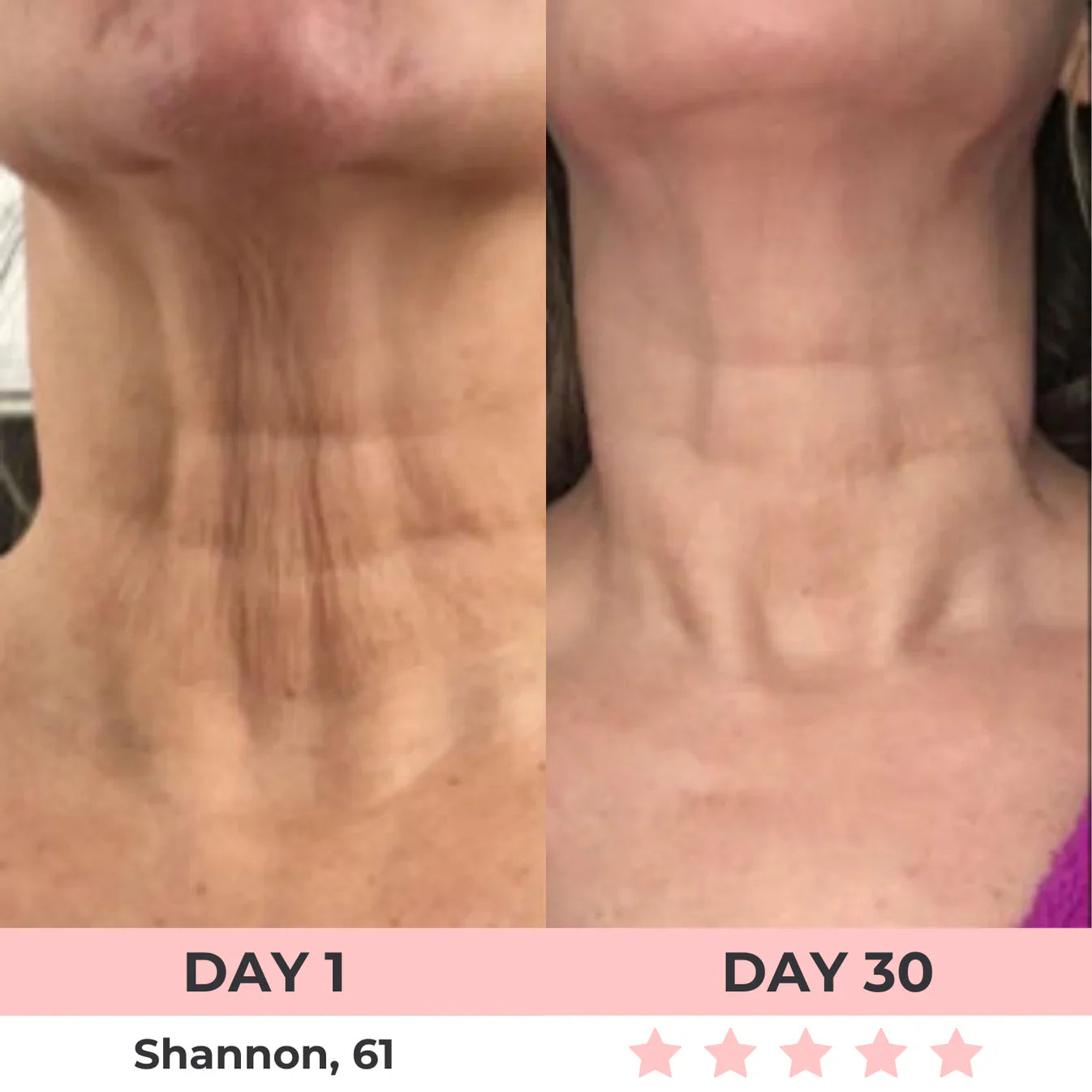 AURORA 7-in-1 LED Facial Sculptor