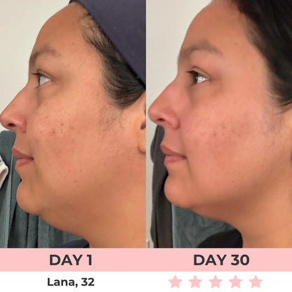 AURORA 7-in-1 LED Facial Sculptor