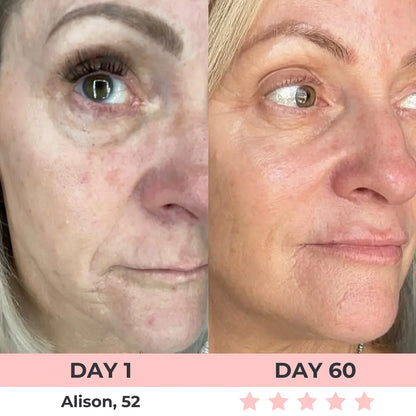 AURORA 7-in-1 LED Facial Sculptor