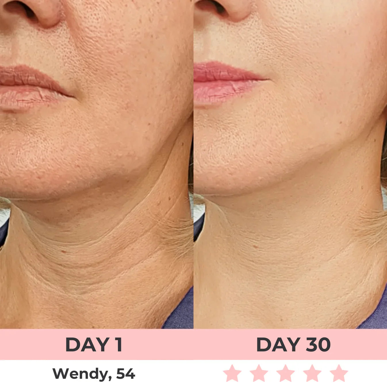 AURORA 7-in-1 LED Facial Sculptor