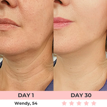 AURORA 7-in-1 LED Facial Sculptor